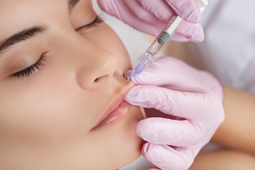 Lip fillers in Hyderabad: Its Benefits