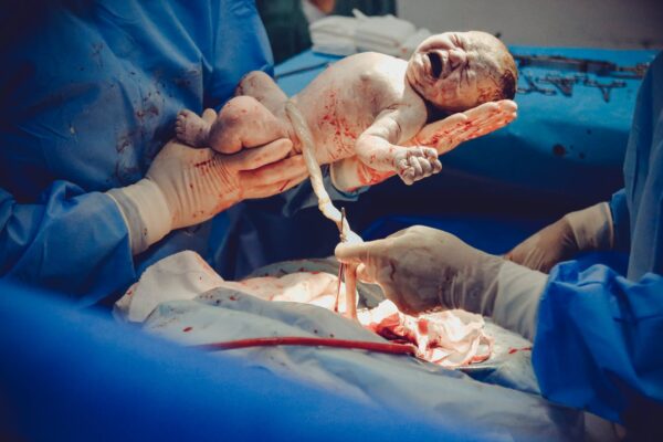 Birth Injuries of Newborn can Impact Future Life