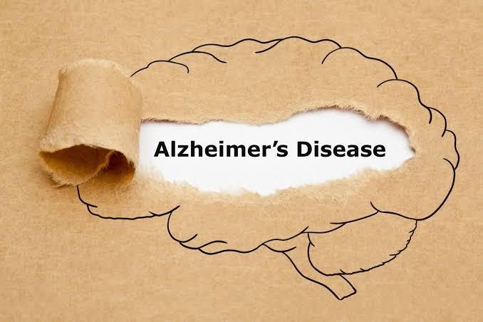 ALZHEIMER’S HEREDITARY