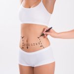 How Painful Is Tummy Tuck Recovery Here’s the Truth (1)
