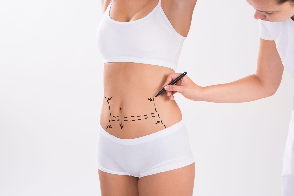 How Painful Is Tummy Tuck Recovery Here’s the Truth (1)