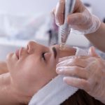 Can Microneedling Benefit You (1)