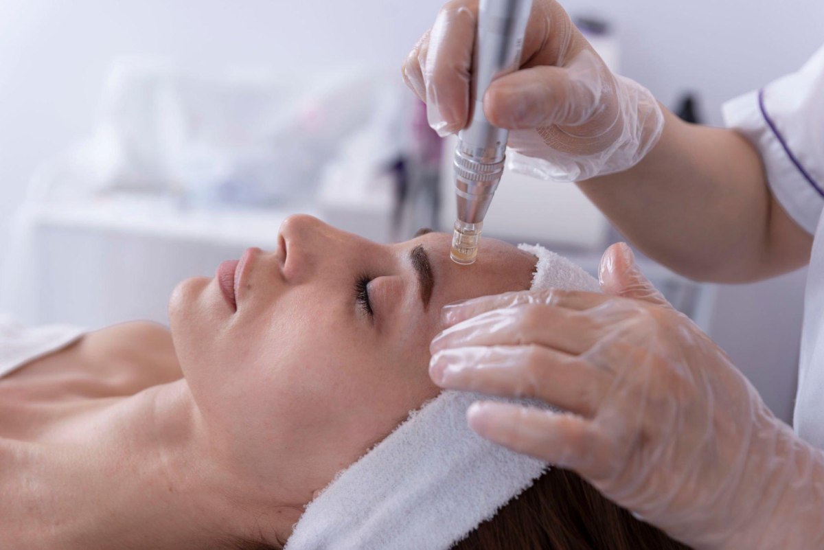 Can Microneedling Benefit You (1)